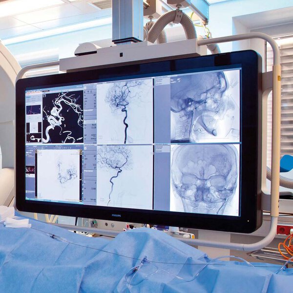 Mergers, Acquisitions, M&A, Health Care, Life Sciences, Medical Devices, Endoscopy, Diagnostic Imaging, Minimal Invasive, Beratung, Berater